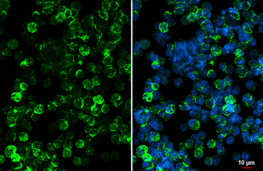 Anti-CD20 antibody [HL6219] used in Immunocytochemistry/ Immunofluorescence (ICC/IF). GTX648311